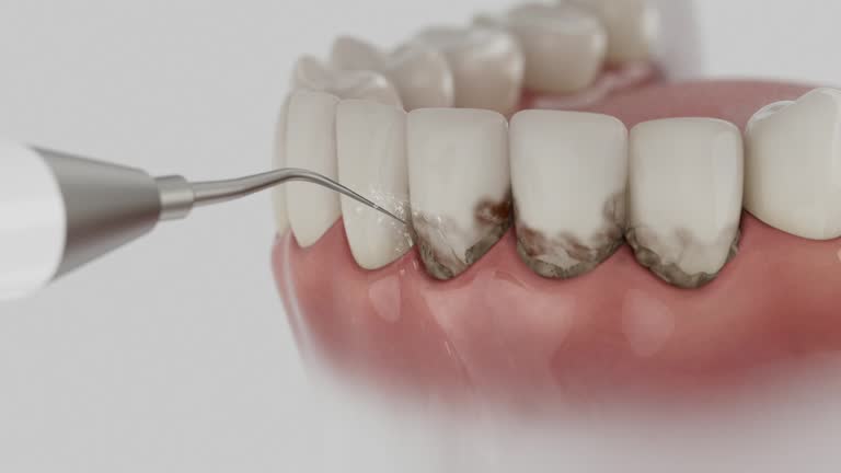Trusted Dental Implants service in Beecher, MI - Dentist Open Now
